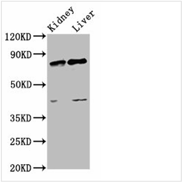 Rabbit anti-SUZ12 Polyclonal Antibody