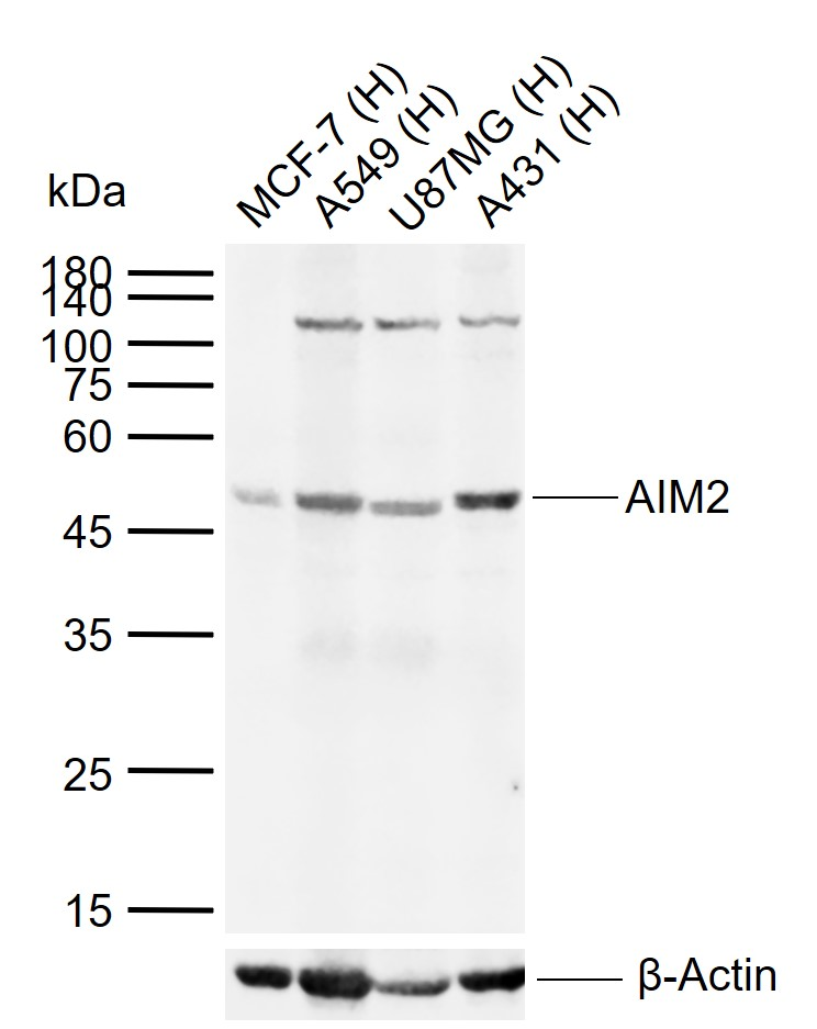 Rabbit anti-AIM2 Polyclonal Antibody