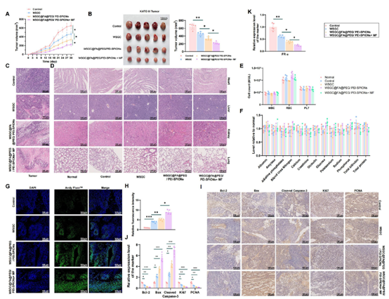 【IF 14.1】突破胃癌化疗耐药！