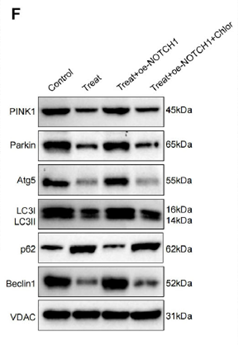 【IF 14.1】突破胃癌化疗耐药！