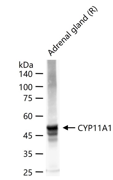 Rabbit anti-CYP11A1 Polyclonal Antibody