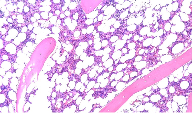 Bone-marrow structure
