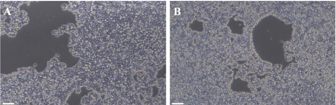 hiPSC dissociation morphology