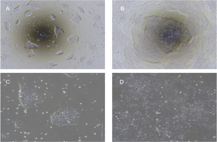 hESC/iPSC morphology