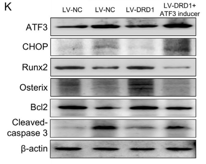 图5K：ATF3诱导剂对DRD1调控作用的逆转（WB结果）