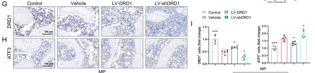 图5G-I：DRD1对ATF3表达的调控（IHC结果）