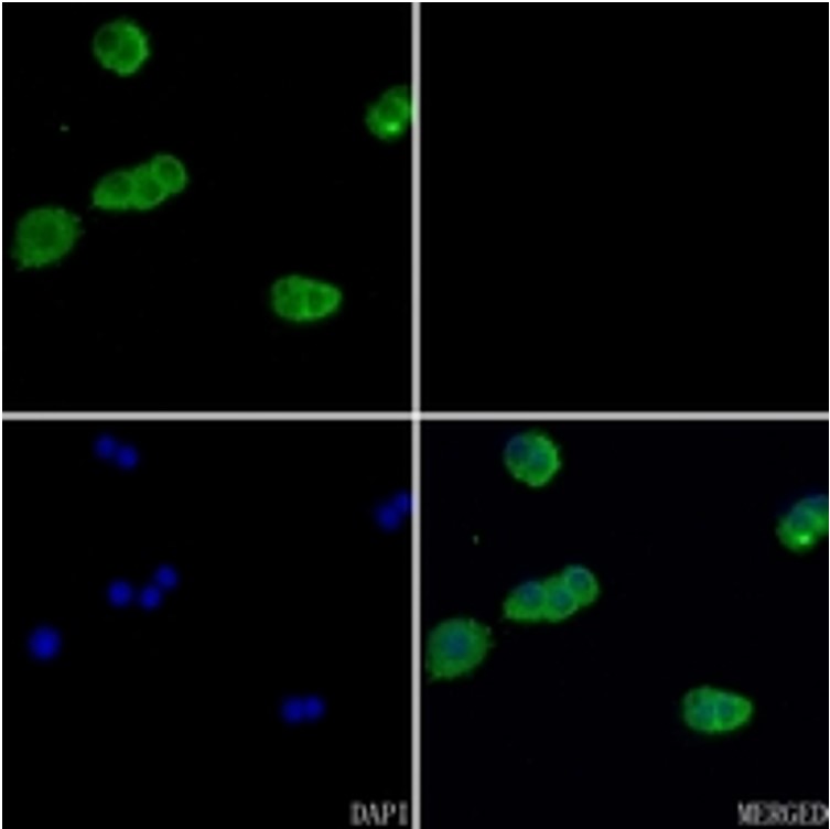 Rabbit anti-β-Actin Polyclonal Antibody