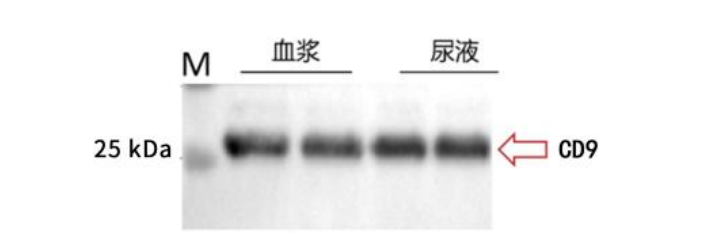 Exosome WB Detection Results