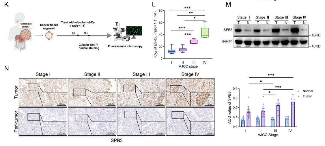 Fig. 1K-N PDAC-related detection across different AJCC stages