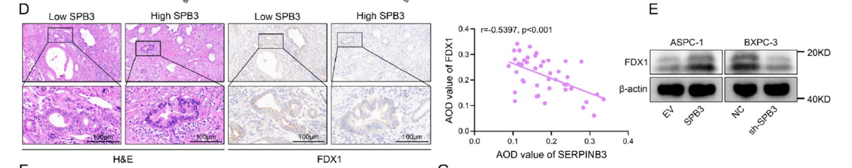 Fig. 3D-E Correlation between SERPINB3 and FDX1 expression