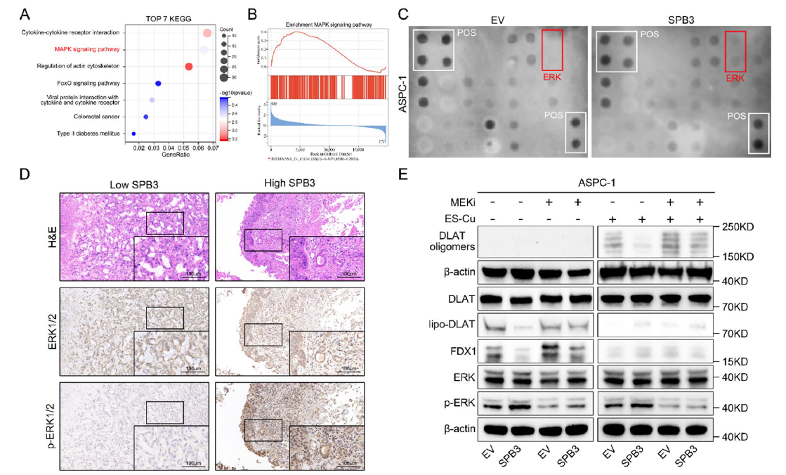 Fig. 4 SERPINB3 induces cuproptosis resistance by activating MAPK signaling pathway