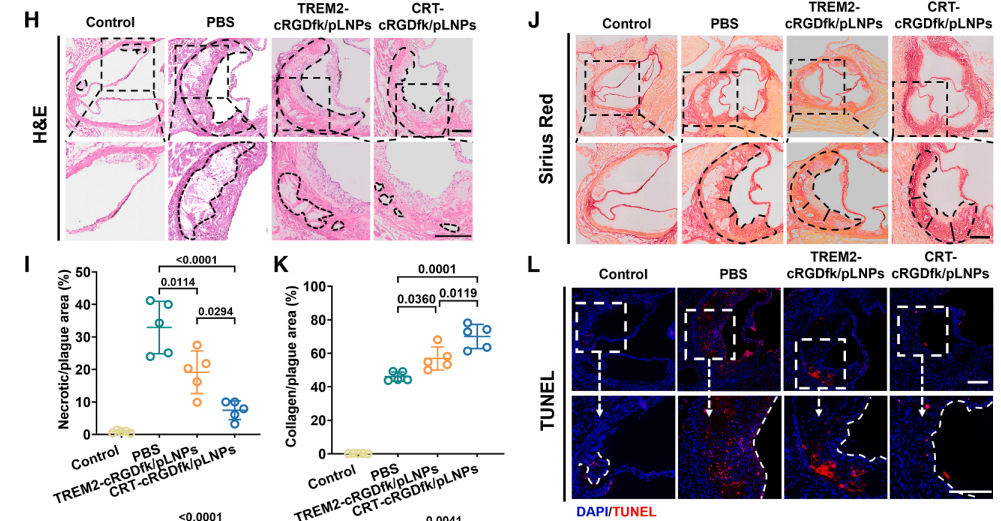 Plaque improvement in atherosclerosis model