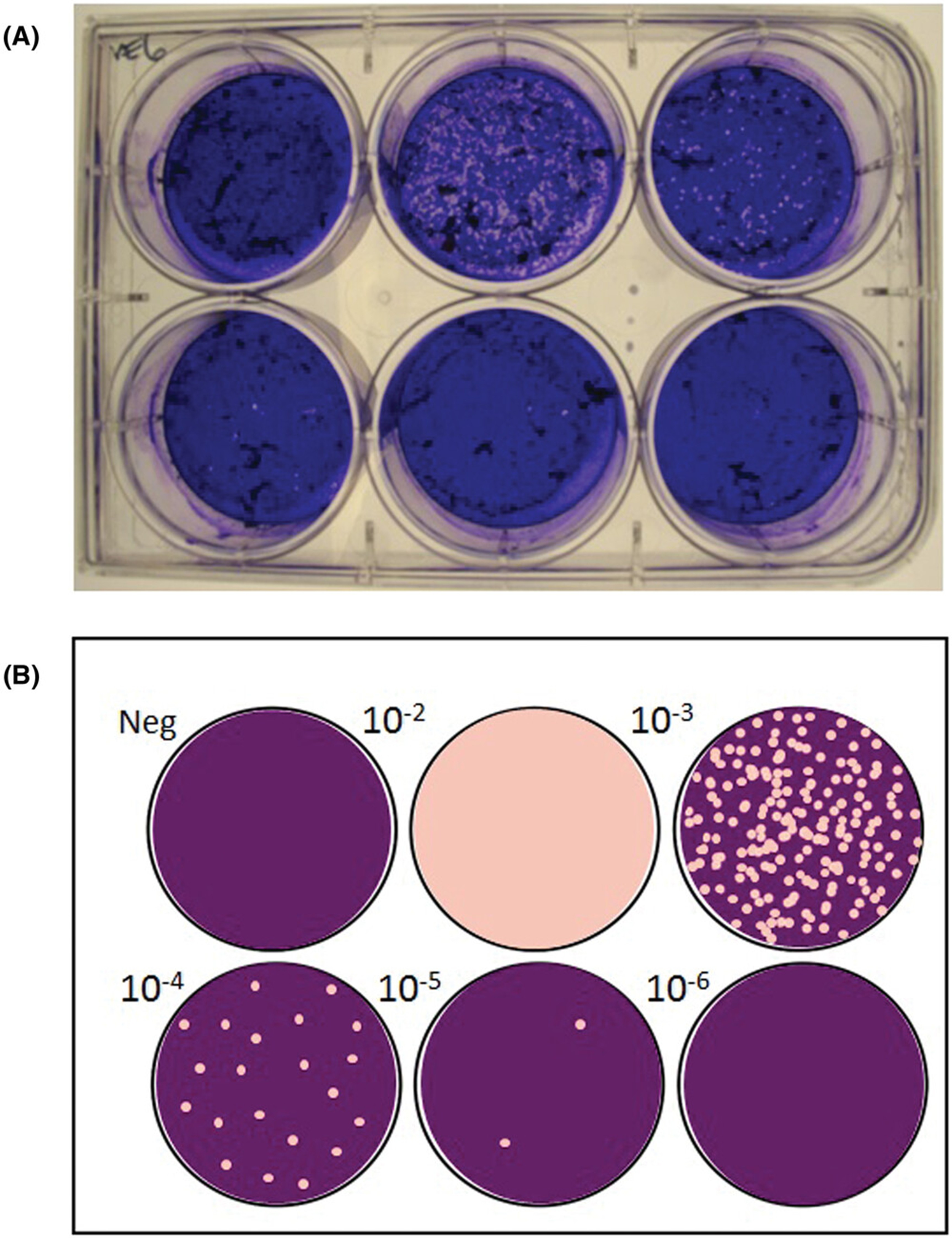 Schematic Diagram of Soft Agar Cloning Assay