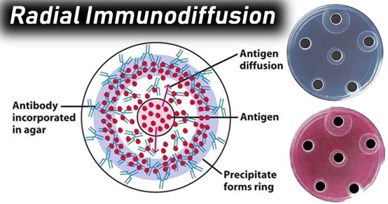 Principle of Radial Immunodiffusion