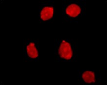 PI-Stained Dead Cells