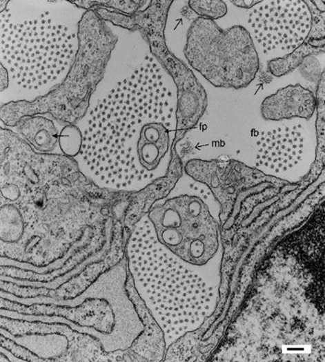 Electron Microscopic Structure of Collagen Fibrils
