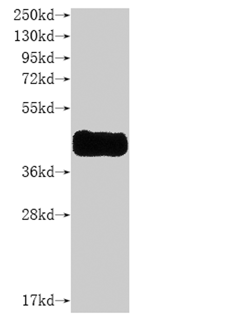 Recombinant Human CCR8-VLPs Protein(C-6His)