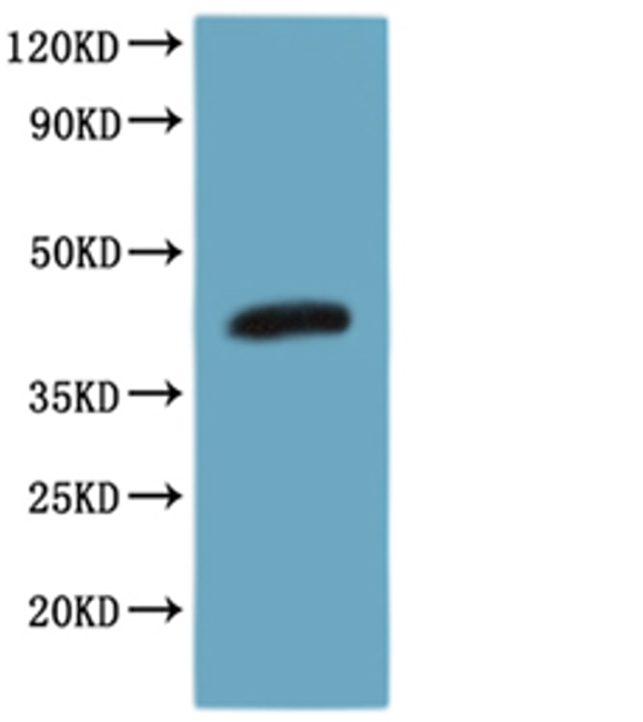 Recombinant Human CCR8-VLPs Protein(C-6His)