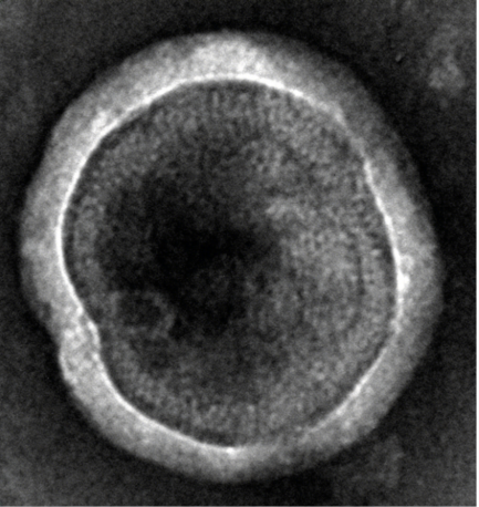 Recombinant Human CCR8-VLPs Protein(C-6His)
