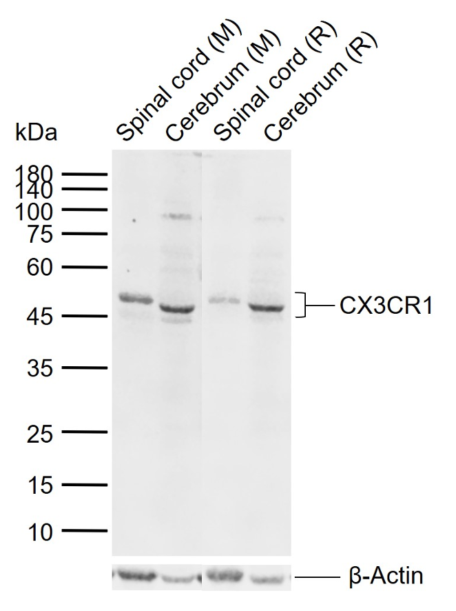 Rabbit anti-CX3CR1 Polyclonal Antibody