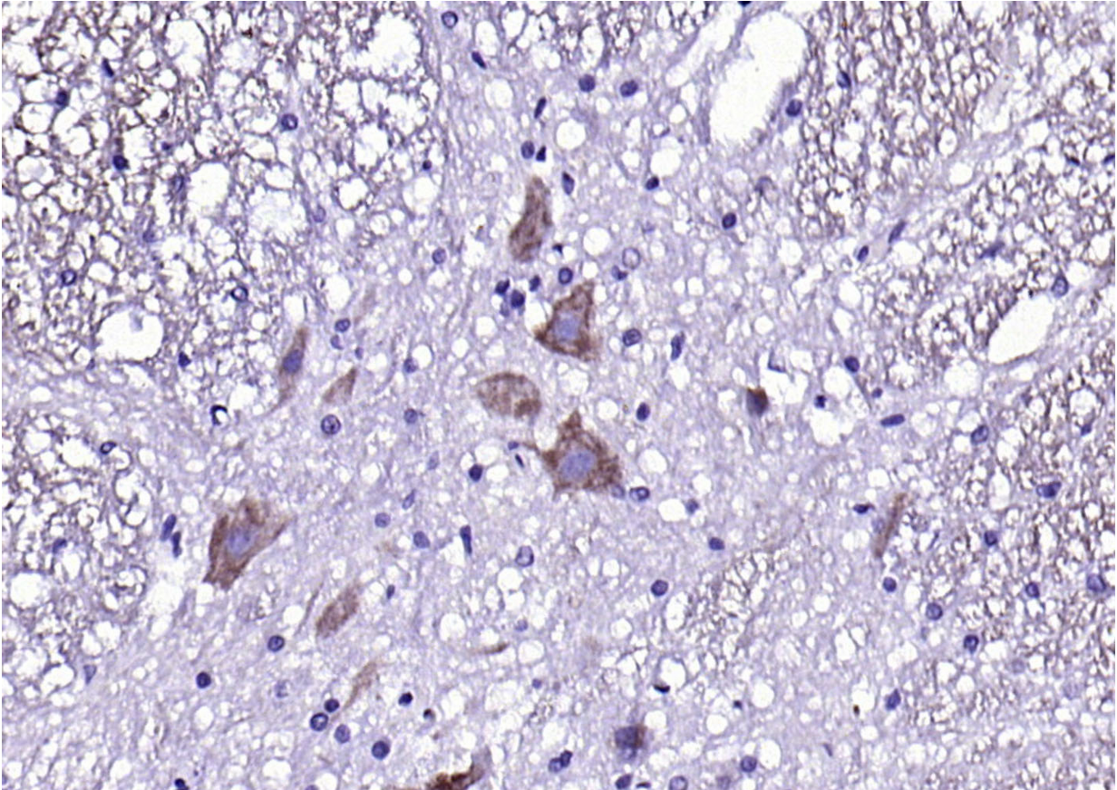 Rabbit anti-CX3CR1 Polyclonal Antibody