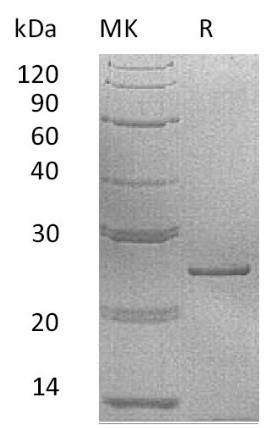 Recombinant Human Prolactin Protein