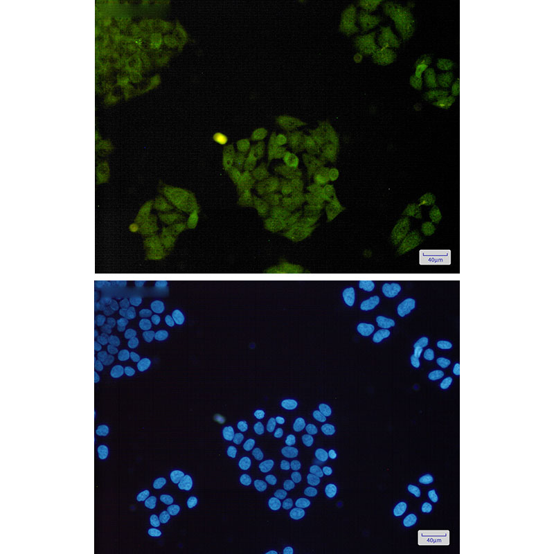Rabbit anti-BRAT1 Monoclonal Antibody(4D9)