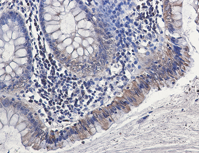 Rabbit anti-Osteopontin Monoclonal Antibody(1C5)
