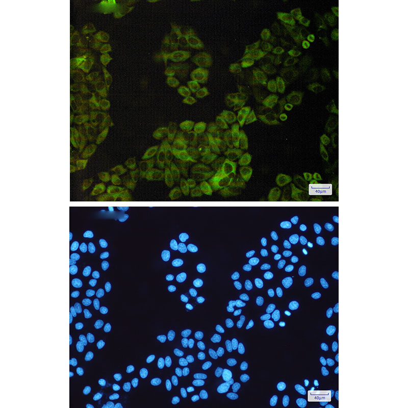 Rabbit anti-NF-KB p100 Monoclonal Antibody(8B2)