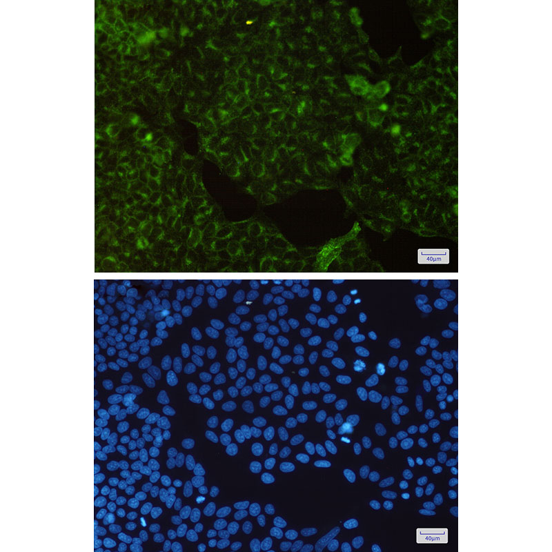 Rabbit anti-Transferrin Receptor 1 Monoclonal Antibody(6H2)