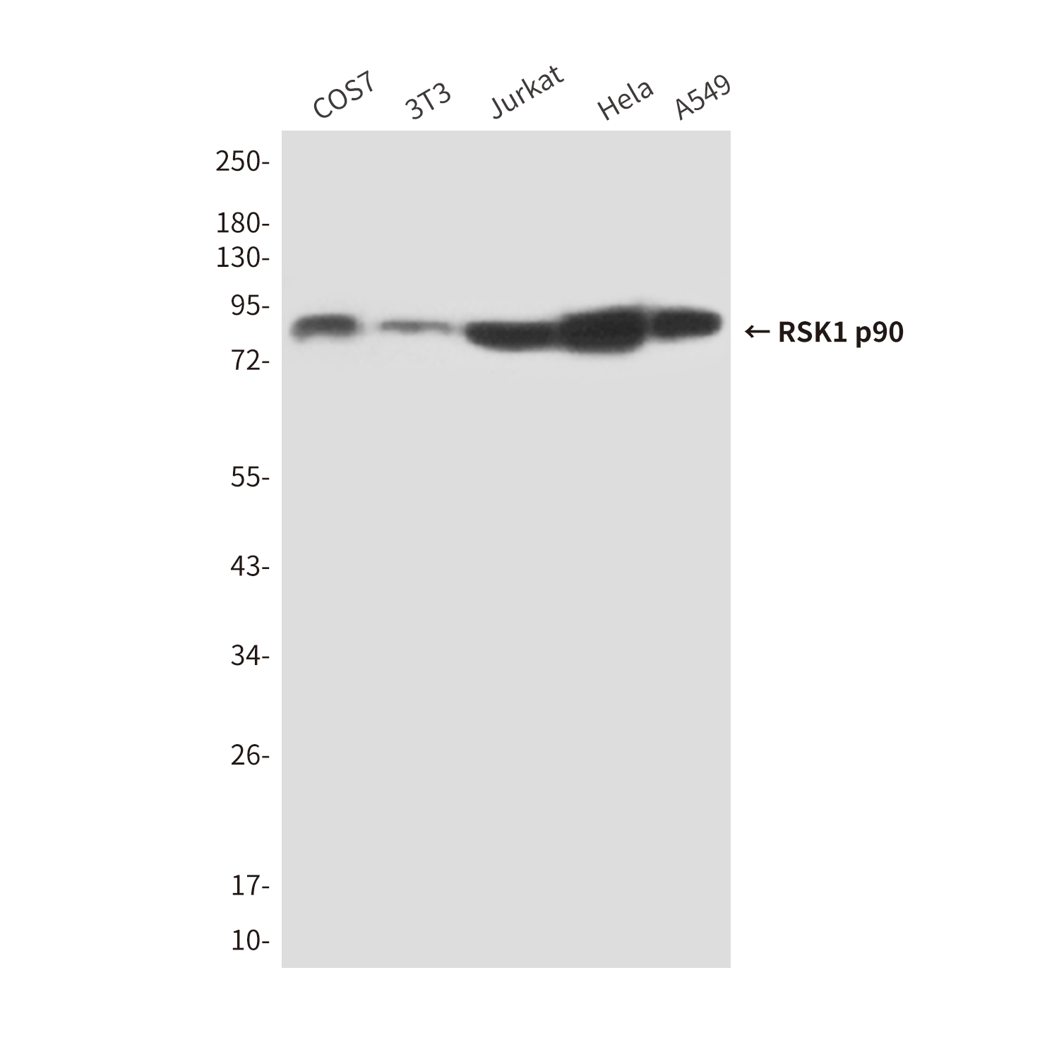 Mouse anti-RSK1 p90 Monoclonal Antibody(6B9)
