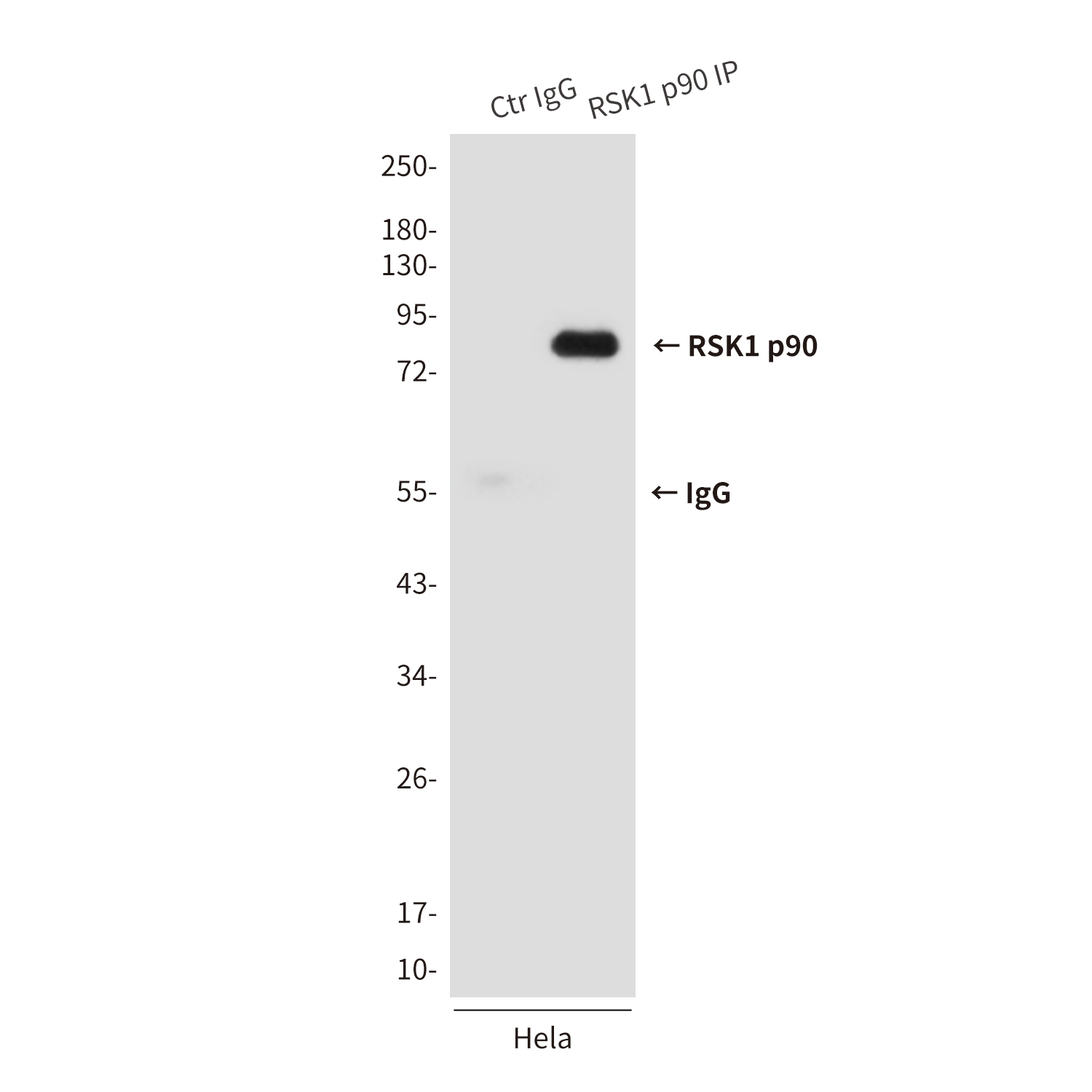 Mouse anti-RSK1 p90 Monoclonal Antibody(6B9)