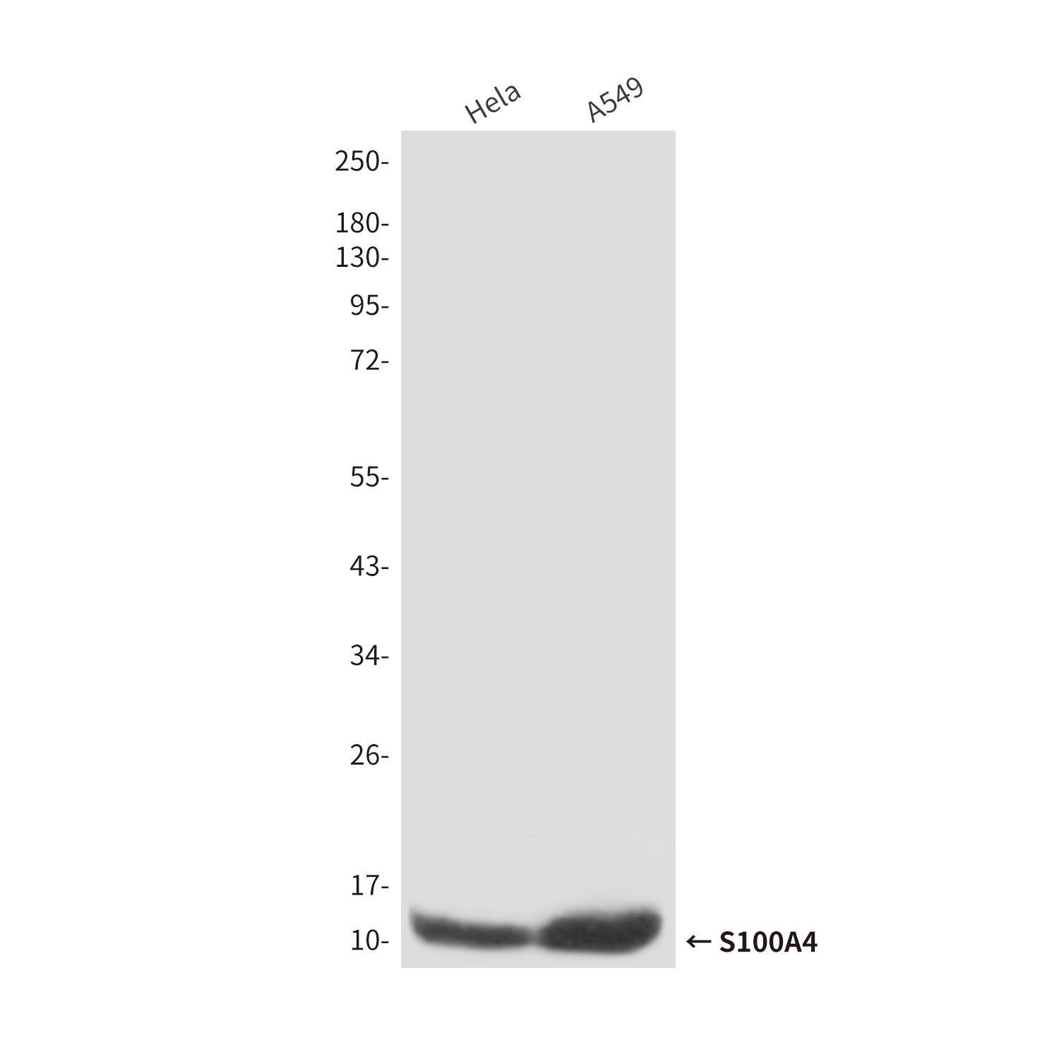 Mouse anti-S100A4 Monoclonal Antibody(3D10)