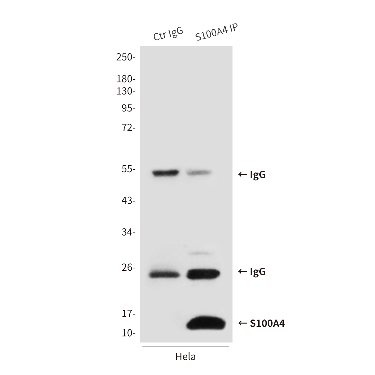 Mouse anti-S100A4 Monoclonal Antibody(3D10)