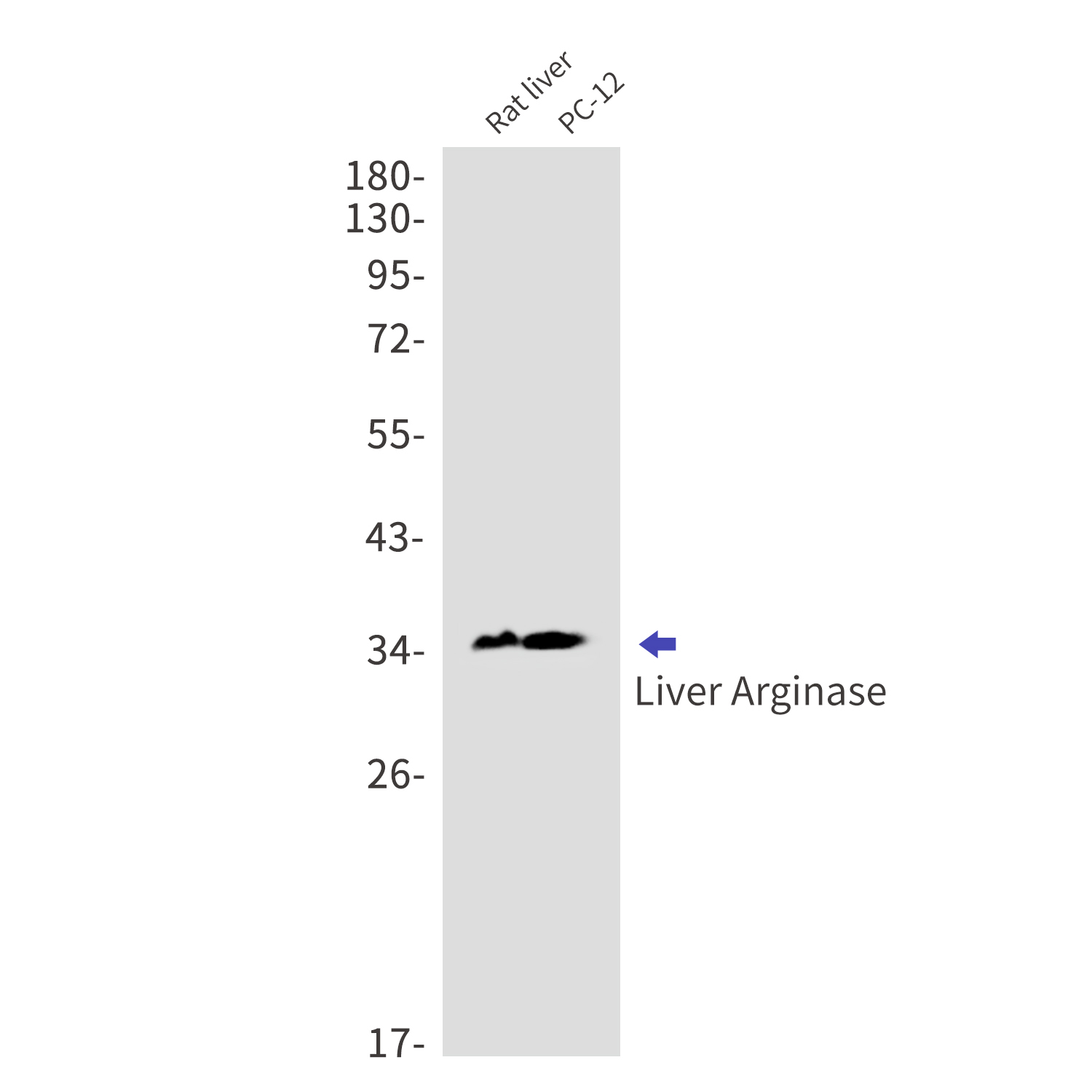 Rabbit anti-Liver Arginase Monoclonal Antibody(6I4)