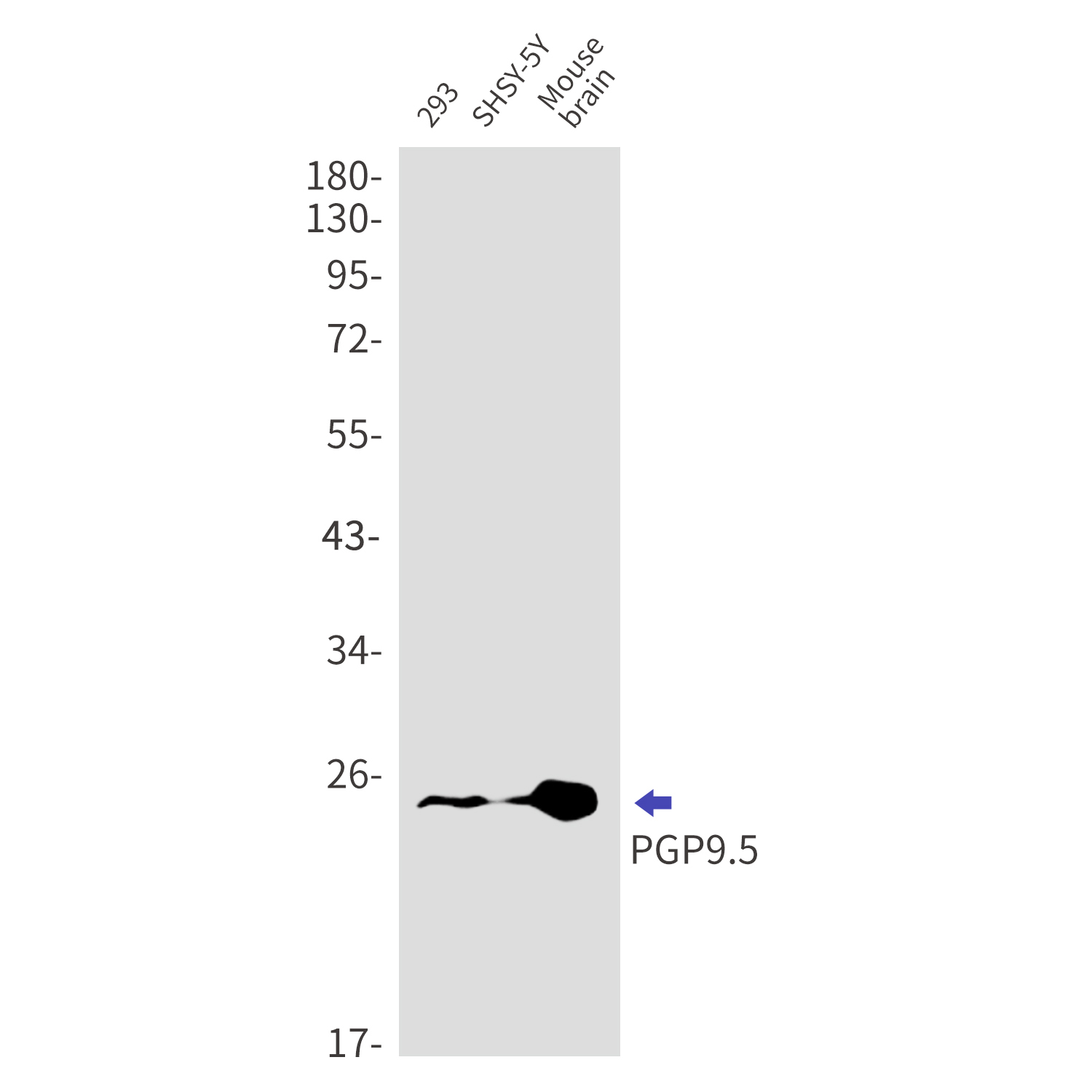 Rabbit anti-PGP9.5 Monoclonal Antibody(6E5)