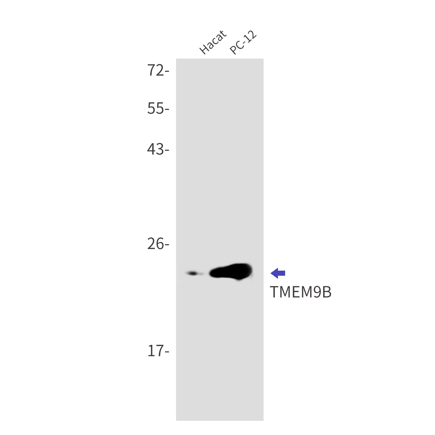 Rabbit anti-Transmembrane Protein 9B Monoclonal Antibody(9C6)