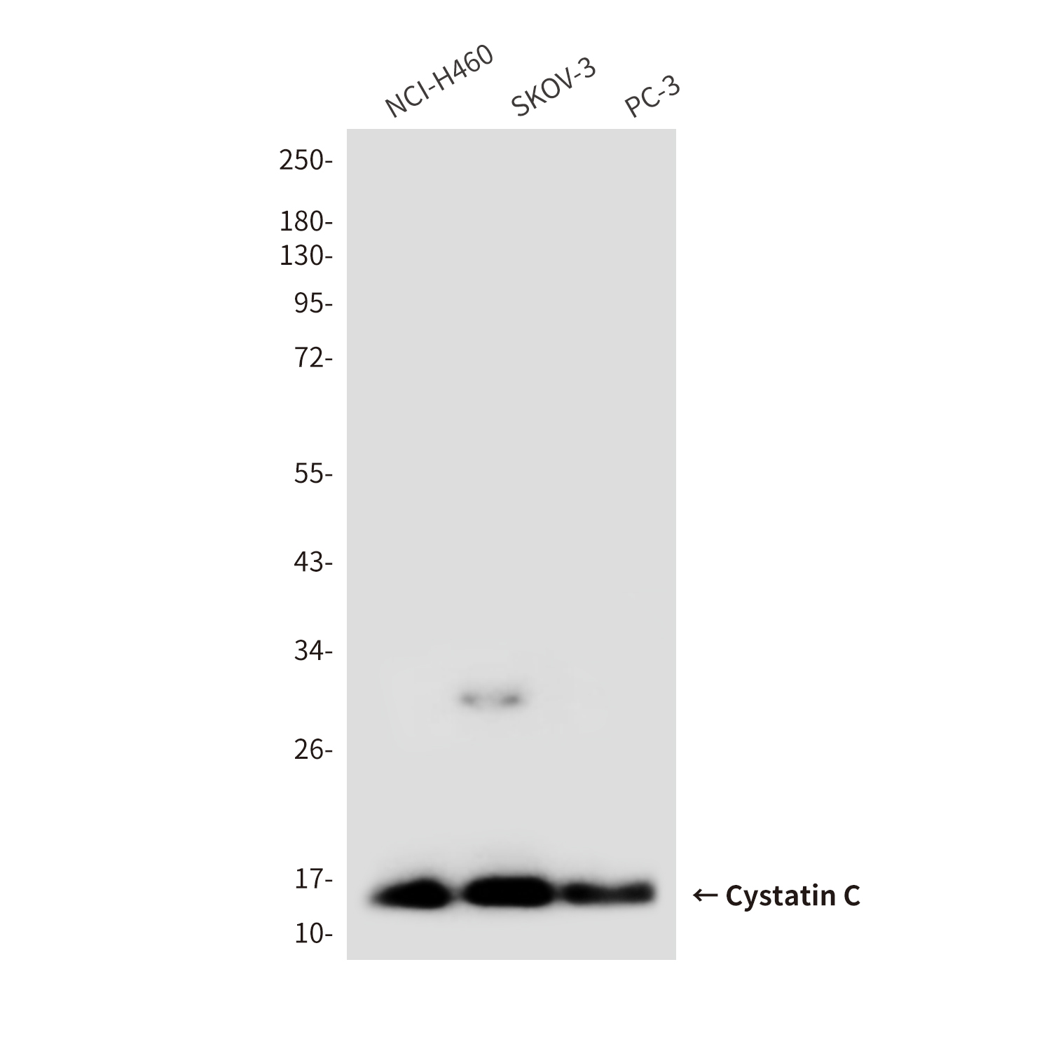 Mouse anti-Cystatin C Monoclonal Antibody(6A4)