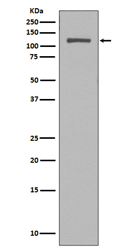Rabbit anti-NUP98 Polyclonal Antibody