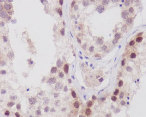Rabbit anti-NUP98 Polyclonal Antibody