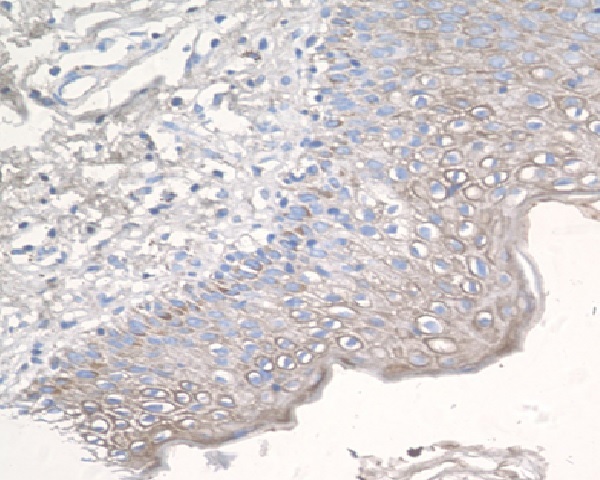 Rabbit anti-CCR3 Polyclonal Antibody