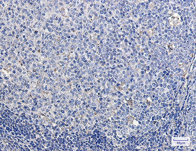 Rabbit anti-LAMP1 Monoclonal Antibody(7D4)