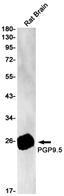Rabbit anti-PGP9.5 Monoclonal Antibody(6E5)