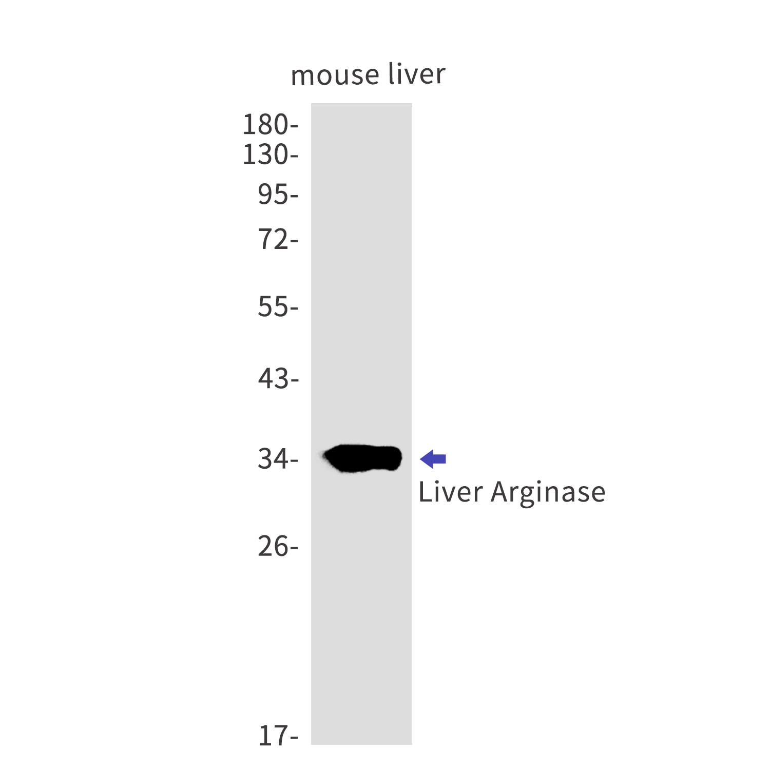 Rabbit anti-Liver Arginase Monoclonal Antibody(6I4)