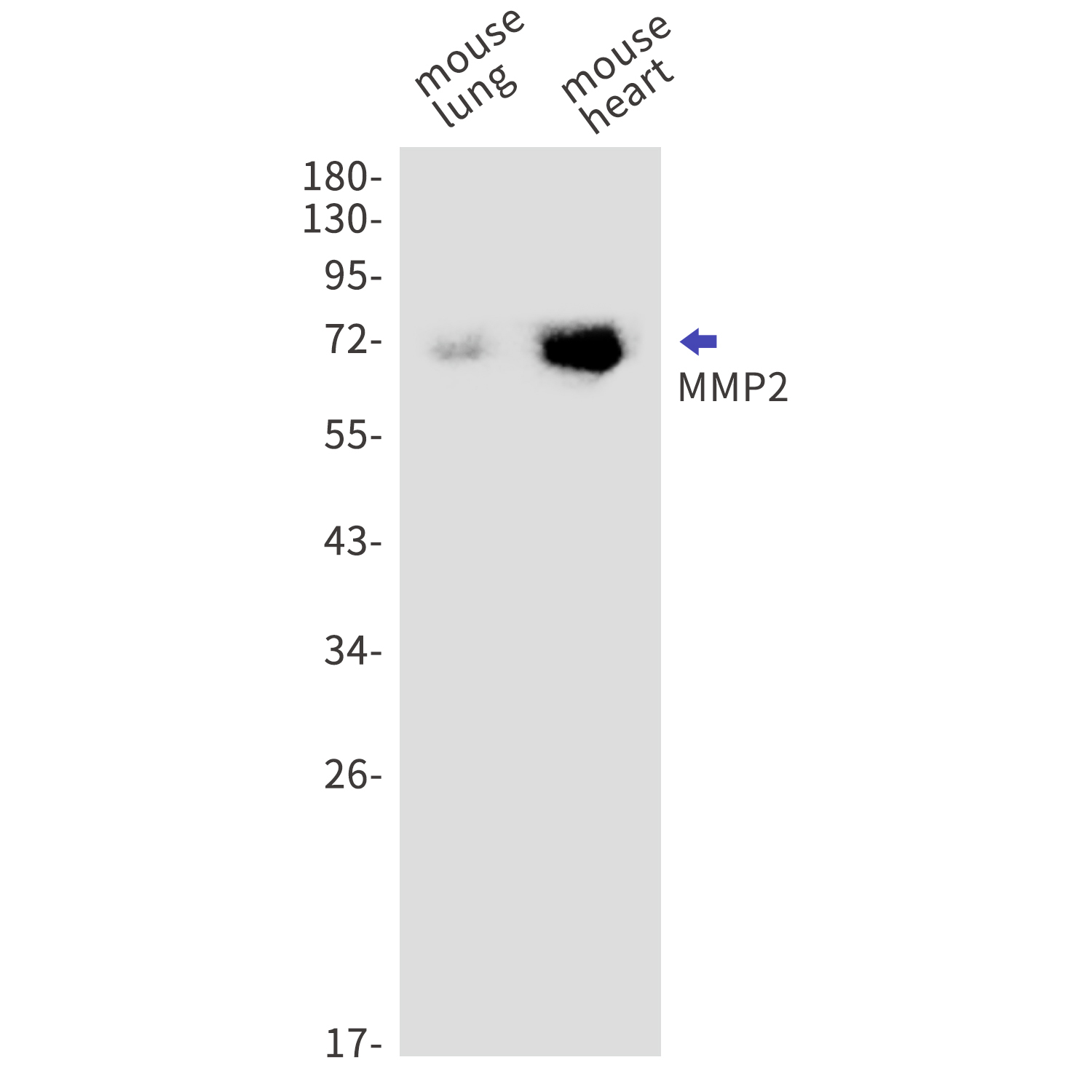 Rabbit anti-MMP2 Monoclonal Antibody(4H3)