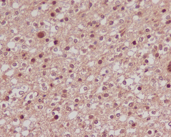 Rabbit anti-FOXO1 Polyclonal Antibody