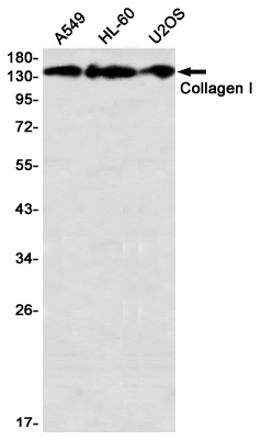 Rabbit anti-Collagen I α1 Monoclonal Antibody(5E5)