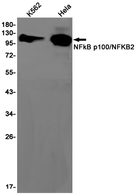 Rabbit anti-NF-KB p100 Monoclonal Antibody(8B2)