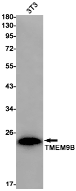 Rabbit anti-Transmembrane Protein 9B Monoclonal Antibody(9C6)