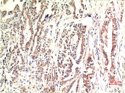 Mouse anti-DDIT3 Monoclonal Antibody(7G7)
